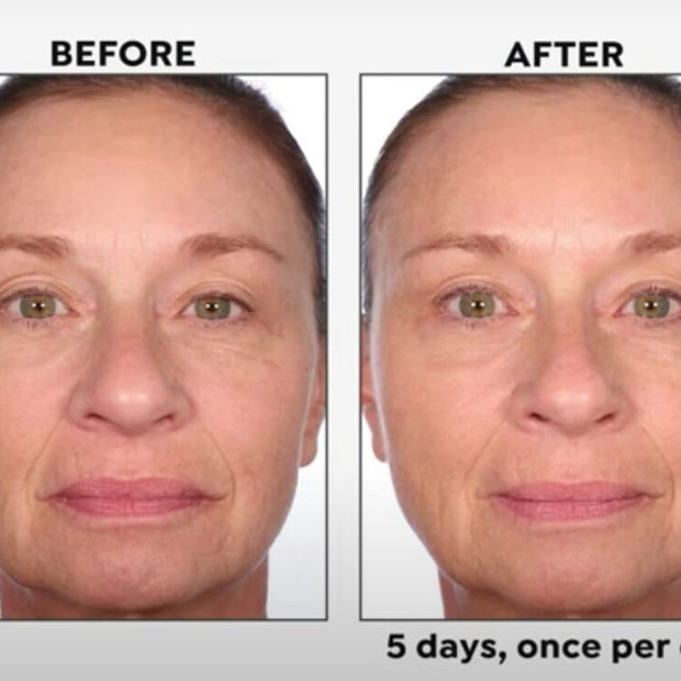 BLACK RICE 5 - DAY BRIGHTENING SERUM - Perlier - SKINCARE, FACE SERUMS & OILS, BLACK RICE